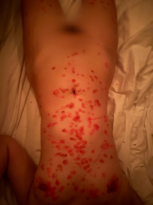 TORI（トウリ） ロウソク責め180分謝謝🥹